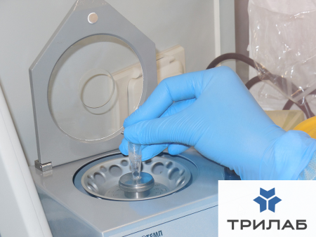 centrifuga_vorteks_4000_obmin_2500g_12_h_15_20_ml_12_h_02_ml_ciklotemp_901_2.jpg